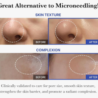 Pore Ampoule 7500.3.png